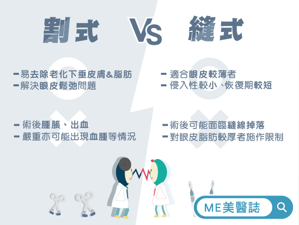 割雙眼皮VS縫雙眼皮